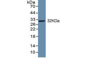 WB of Protein Standard: different control antibody against Highly purified E.