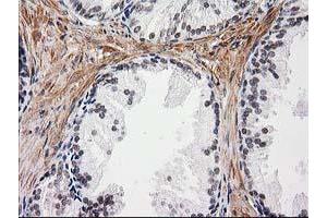 Image no. 1 for anti-Nicotinamide N-Methyltransferase (NNMT) antibody (ABIN1499790)