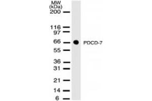 Western Blotting (WB) image for anti-Programmed Cell Death 7 (PDCD7) antibody (ABIN207864) (PDCD7 anticorps)