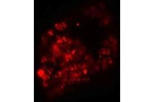Immunofluorescence of PRICKLE1 in human bladder cells with PRICKLE1 antibody at 20 ug/mL.