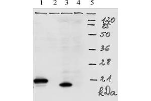 Western-Blot analysis of HPV-18 E7 protein. (HPV18 E7 anticorps  (AA 1-35))