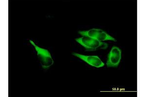 Immunofluorescence of purified MaxPab antibody to MTHFD1 on HeLa cell.