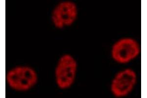 anti-Signal Transducer and Activator of Transcription 5A (STAT5A) (pTyr694) antibody