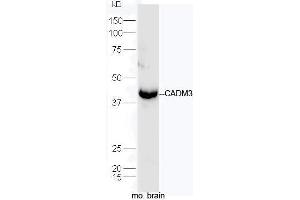 Mouse brain lysates probed with Rabbit Anti-CADM3 Polyclonal Antibody, Unconjugated  at 1:5000 for 90 min at 37˚C. (CADM3 anticorps  (AA 101-200))