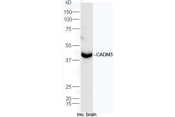 CADM3 anticorps  (AA 101-200)