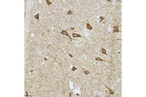 Immunohistochemistry of paraffin-embedded human brain using EP/HIF2α Rabbit pAb (ABIN6127869, ABIN6141764, ABIN6141765 and ABIN6223457) at dilution of 1:100 (40x lens).