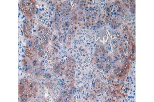 IHC-P analysis of adrenal gland tissue, with DAB staining. (CPT1A anticorps  (AA 572-773))