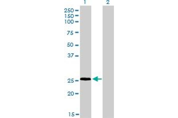 RNF141 Antikörper  (AA 141-229)