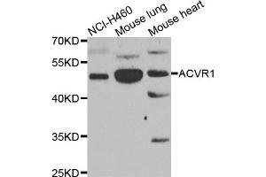 Western blot analysis of extracts of various cell lines, using ACVR1 antibody. (ACVR1 anticorps)