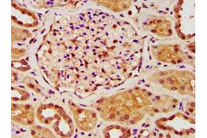 IHC image of ABIN7176620 diluted at 1:200 and staining in paraffin-embedded human kidney tissue performed on a Leica BondTM system. (ZKSCAN5 anticorps  (AA 490-643))