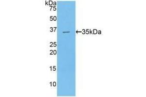 CPB2 anticorps  (AA 138-386)