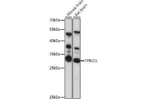 Western blot analysis of extracts of various cell lines, using TPRG1L antibody (ABIN7271100) at 1:1000 dilution.