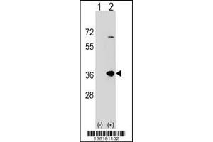 Western blot analysis of SULT1B1 using rabbit polyclonal SULT1B1 Antibody using 293 cell lysates (2 ug/lane) either nontransfected (Lane 1) or transiently transfected (Lane 2) with the SULT1B1 gene.