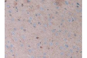 Detection of CA2 in Rat Cerebrum Tissue using Polyclonal Antibody to Carbonic Anhydrase II (CA2)