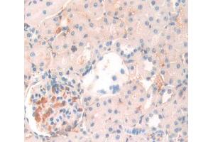 IHC-P analysis of Kidney tissue, with DAB staining. (ANGPTL4 anticorps  (AA 228-389))