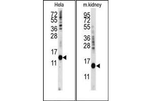 Image no. 1 for anti-Cytidine Deaminase (CDA) (C-Term) antibody (ABIN358052) (CDA anticorps  (C-Term))