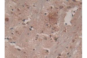 DAB staining on IHC-P; Samples: Rat Brain Tissue (CSF1R anticorps  (AA 734-900))