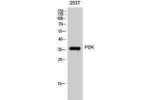 Western Blotting (WB) image for anti-PDZ Binding Kinase (PBK) (Tyr685), (Tyr753) antibody (ABIN3186349) (PBK anticorps  (Tyr685, Tyr753))