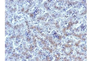Formalin-fixed, paraffin-embedded human Fetal Liver stained with Glypican-3 Rabbit Polyclonal Antibody. (Glypican 3 anticorps)