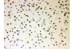 Anti-PKC iota Picoband antibody, (ABIN3043909),IHC(P)IHC(P): Rat Brain Tissue (PKC iota anticorps  (AA 21-214))