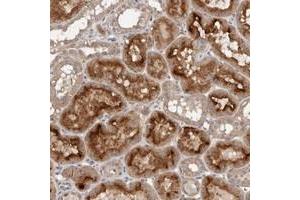Immunohistochemical staining of human kidney with GRAMD2 polyclonal antibody  shows strong cytoplasmic and membranous positivity in tubular cells. (GRAMD2 anticorps)