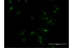 Immunofluorescence of monoclonal antibody to MSX1 on HeLa cell.