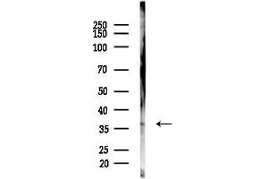 anti-Growth Arrest-Specific 1 (GAS1) (Internal Region) antibody