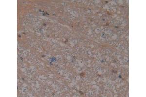 IHC-P analysis of Rat Tissue, with DAB staining. (THBS4 anticorps  (AA 708-963))