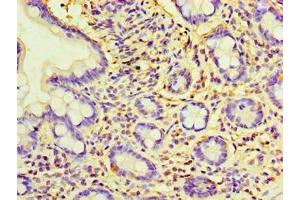 Immunohistochemistry of paraffin-embedded human small intestine tissue using ABIN7157764 at dilution of 1:100