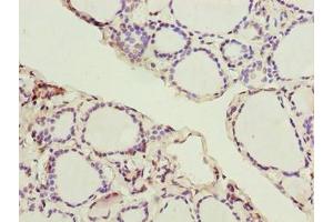 Immunohistochemistry of paraffin-embedded human thyroid tissue using ABIN7170271 at dilution of 1:100 (GPR172B anticorps  (AA 212-279))
