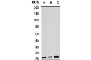 Western blot analysis of ARL6 expression in HEK293T (A), mouse kidney (B), mouse brain (C) whole cell lysates. (ARL6 anticorps)