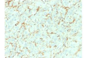 Formalin-fixed, paraffin-embedded human Adrenal Gland stained with NGFR Mouse Monoclonal Antibody (NGFR/1964). (NGFR anticorps  (AA 281-421))