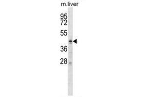 ZDHHC6 Antibody (C-term) western blot analysis in mouse liver tissue lysates (35 µg/lane). (ZDHHC6 anticorps  (C-Term))