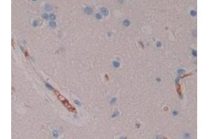 Detection of NXN in Human Cerebrum Tissue using Polyclonal Antibody to Nucleoredoxin (NXN) (NXN anticorps  (AA 166-327))