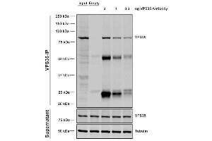 Immunoprecipitation analysis using Mouse Anti-VPS35 Monoclonal Antibody, Clone 5A9 (ABIN6932942).