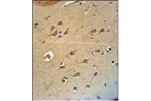 RAT DLG4 Antibody (C-term)(Ascites) ABIN658997 immunohistochemistry analysis in formalin fixed and paraffin embedded human brain tissue followed by peroxidase conjμgation of the secondary antibody and DAB staining.
