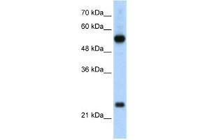 WB Suggested Anti-RPL13 Antibody Titration:  2. (RPL13 anticorps  (C-Term))