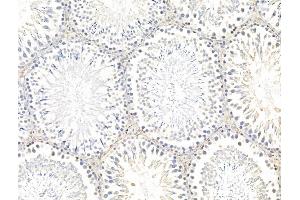 ABIN7094753 and ABIN7098804 at 1/100 staining Rat testis tissue by IHC-P. (SSX2IP anticorps  (Internal Region))