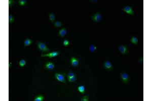 Immunofluorescent analysis of A2780 cells using ABIN7173225 at dilution of 1:100 and Alexa Fluor 488-congugated AffiniPure Goat Anti-Rabbit IgG(H+L) (TMEM45A anticorps  (AA 171-217))