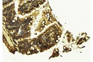 ABIN6277056 at 1/100 staining Mouse colon tissue by IHC-P.