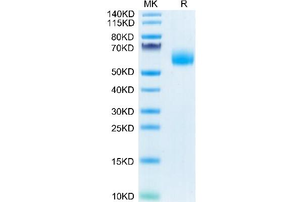 IL1RL2 Protein (Cys154Ser-Mutant, Cys262Ser-Mutant) (His tag)