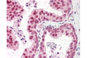 Anti-TSHZ3 antibody IHC staining of human prostate. (TSHZ3 anticorps  (N-Term))