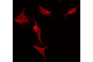 ABIN6274415 staining A549 by IF/ICC.