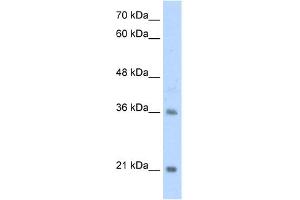 WB Suggested Anti-TCF15 Antibody Titration:  2. (TCF15 anticorps  (N-Term))