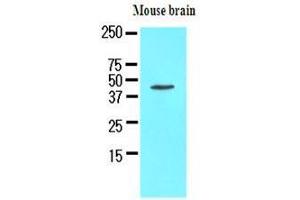 The extracts of mouse brain (50 ug) were resolved by SDS-PAGE, transferred to nitrocellulose membrane and probed with anti-human Homer1 (1:1000). (HOMER1 anticorps  (AA 1-354))