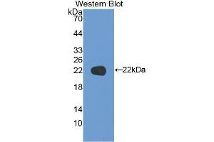 Western blot analysis of the recombinant protein. (KRT17 anticorps  (AA 252-393))