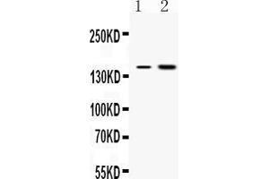 Western blot analysis of Insulin Receptor expression in rat kidney extract ( Lane 1) and HEPG2 whole cell lysates ( Lane 2). (Insulin Receptor anticorps  (N-Term))
