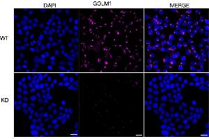 Immunocytochemical staining of HeLa cells using GOLM1 antibody (ABIN7798793), 1:1,000), Top panel: wild-type (WT), Bottom panal: GOLM1 shRNA knockdown (KD). (GOLM1 anticorps)