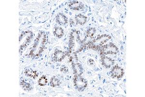 Immunohistochemistry (IHC) image for anti-GATA Binding Protein 3 (GATA3) (AA 150-200) antibody (ABIN7455153)