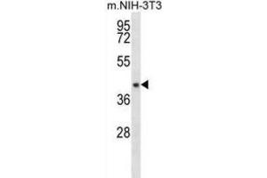 Western Blotting (WB) image for anti-Nudix (Nucleoside Diphosphate Linked Moiety X)-Type Motif 9 (NUDT9) antibody (ABIN2996610) (NUDT9 anticorps)